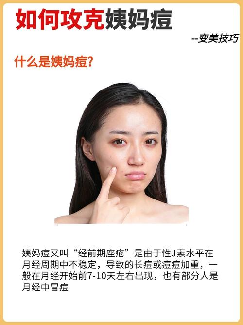 来例假为什么长痘
