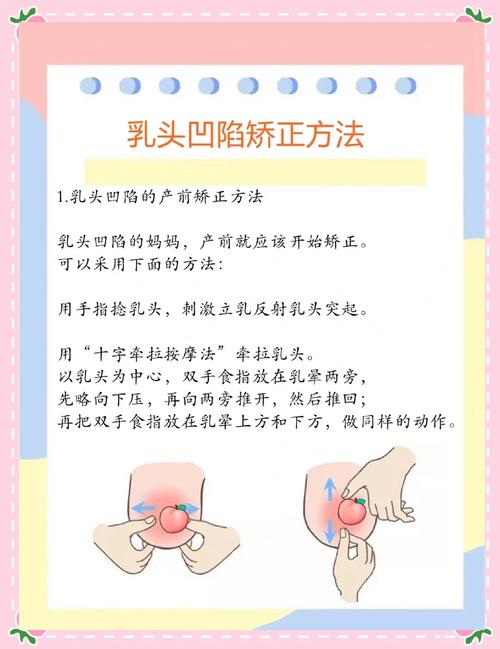 乳头挺立什么原因