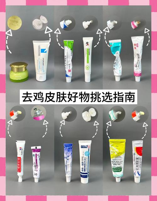 鸡皮肤擦什么药膏