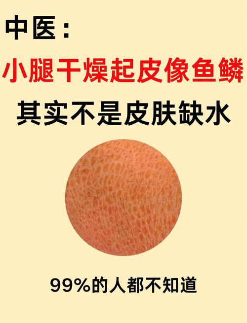减肥皮肤干燥为什么