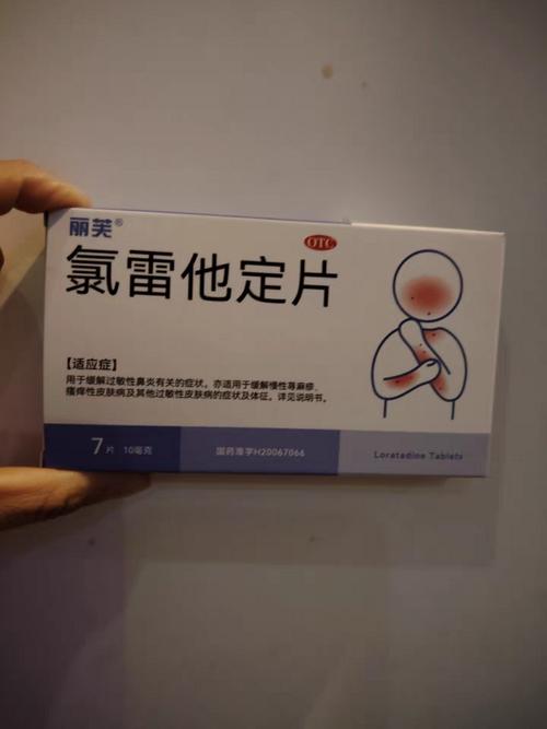 化妆品过敏吃什么药