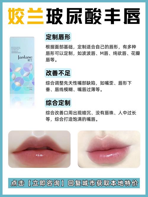丰唇是什么意思