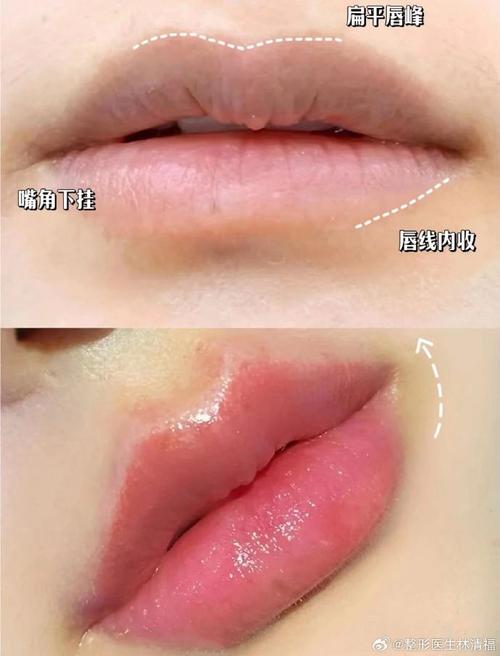 丰唇是什么意思