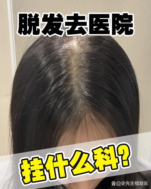 掉发去医院挂什么科