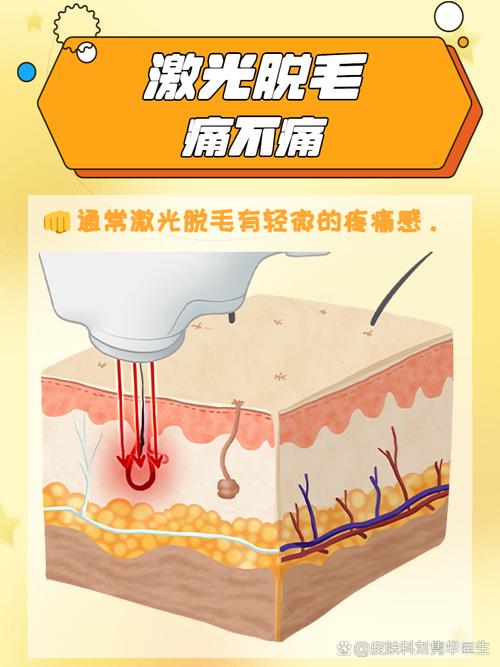 激光脱毛有什么危害