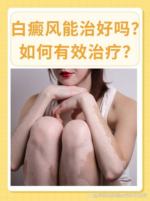 什么原因引起白癜风