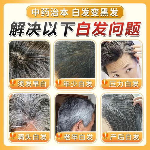 吃什么能使头发变黑