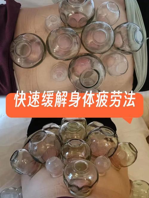 针灸拔罐减肥后吃什么