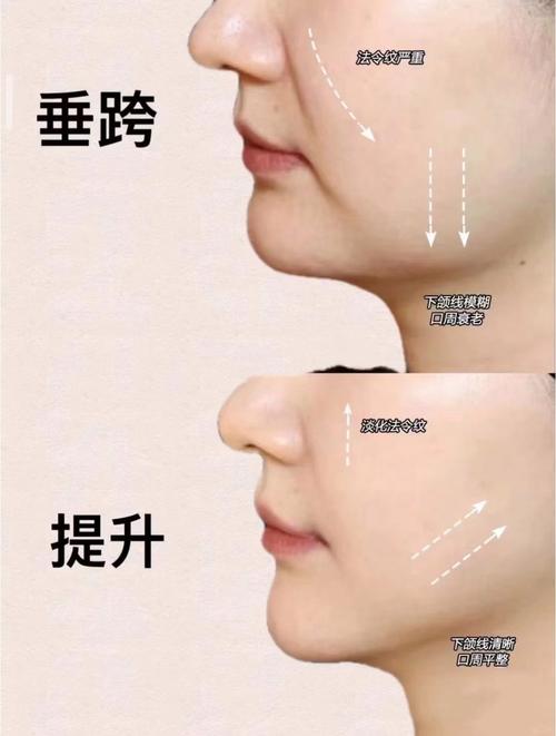 什么是面部提升