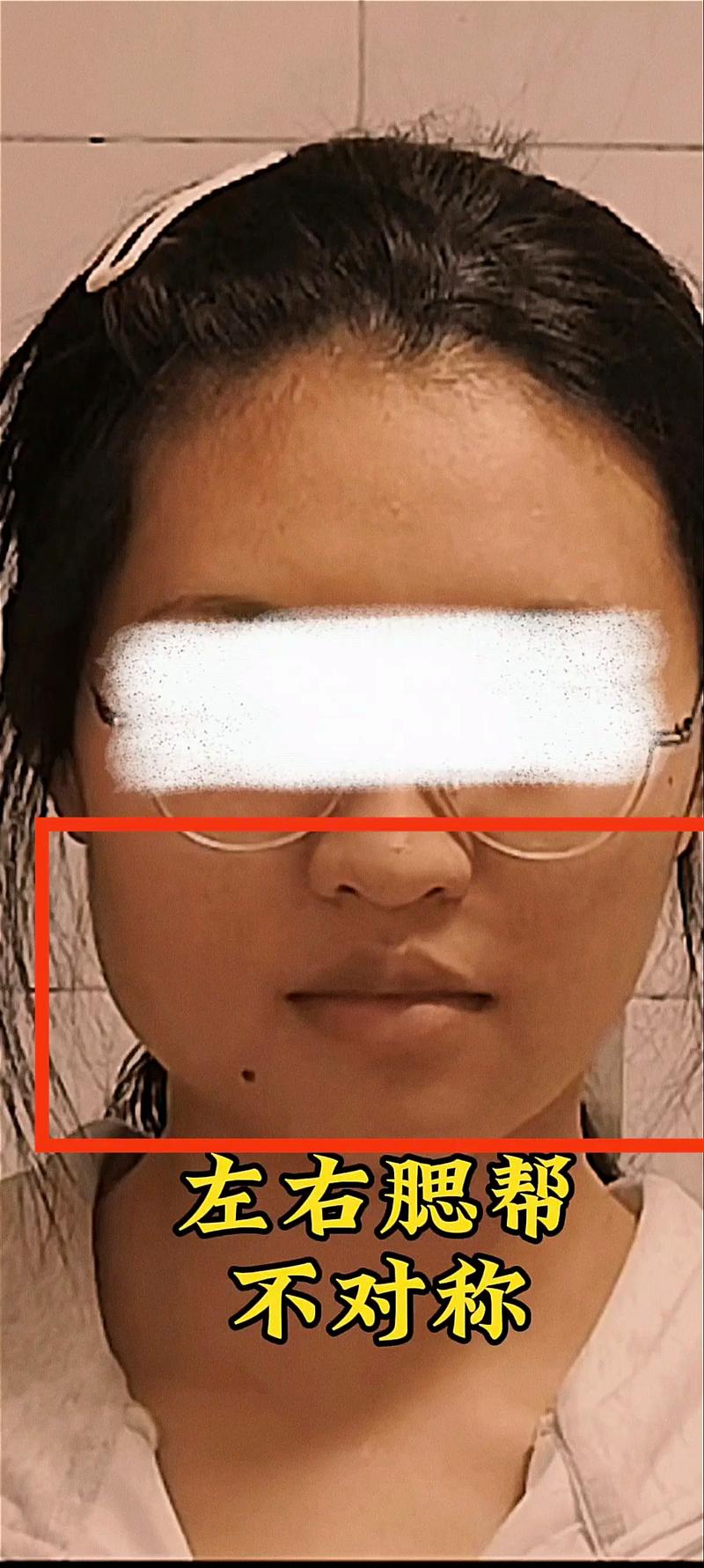 为什么脸两边不对称
