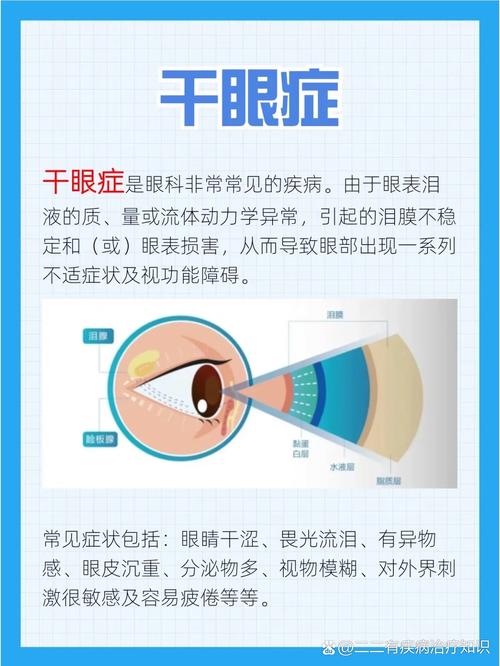 眼睛干痛是什么原因