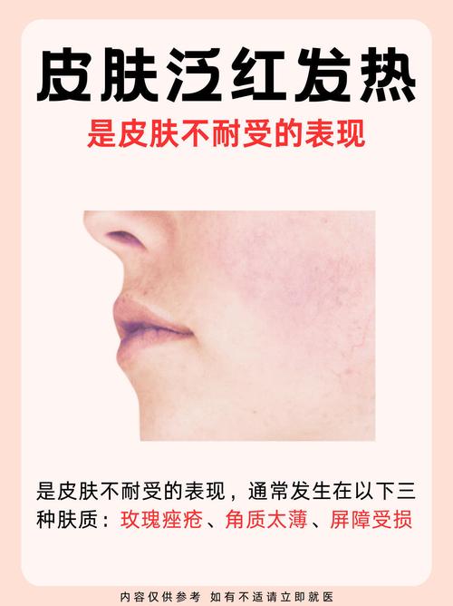 面部潮红是什么原因