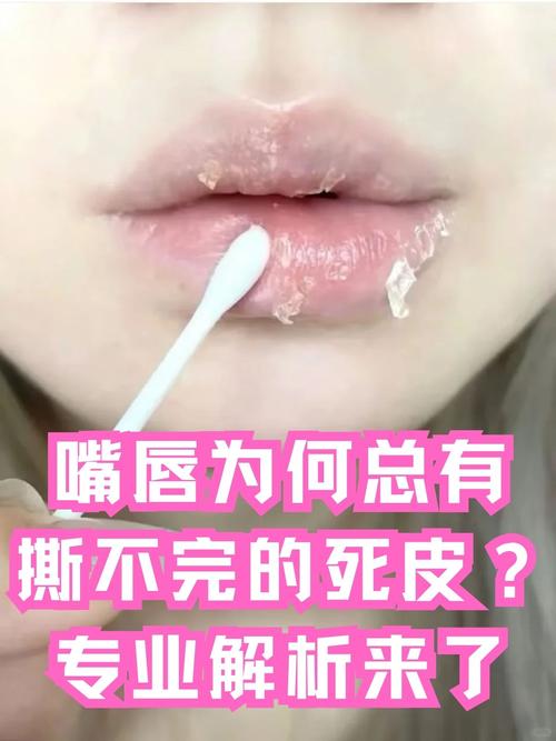 嘴唇掉皮是什么原因