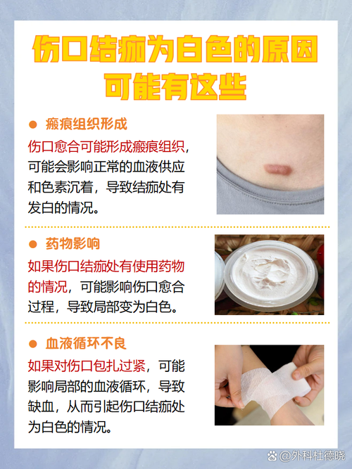 脱痂是什么意思
