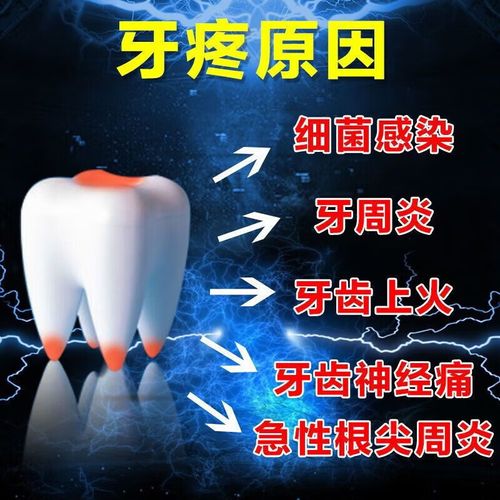 牙痛用什么止痛药