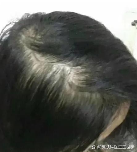 人为什么要长头发