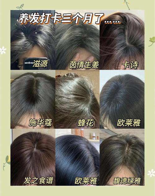 什么东西治脱发