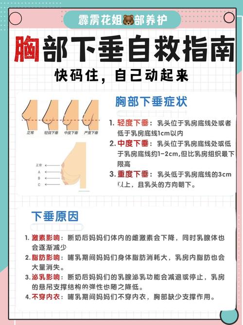 乳房下垂什么原因
