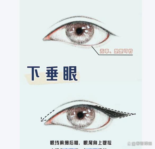 眼角下垂是什么眼