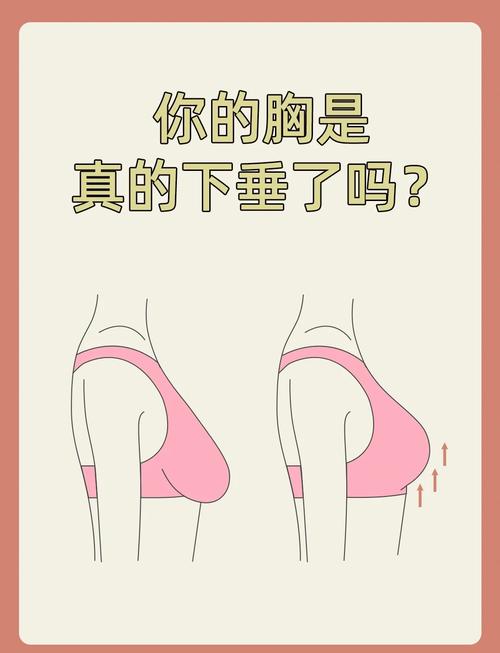 什么原因乳房下垂
