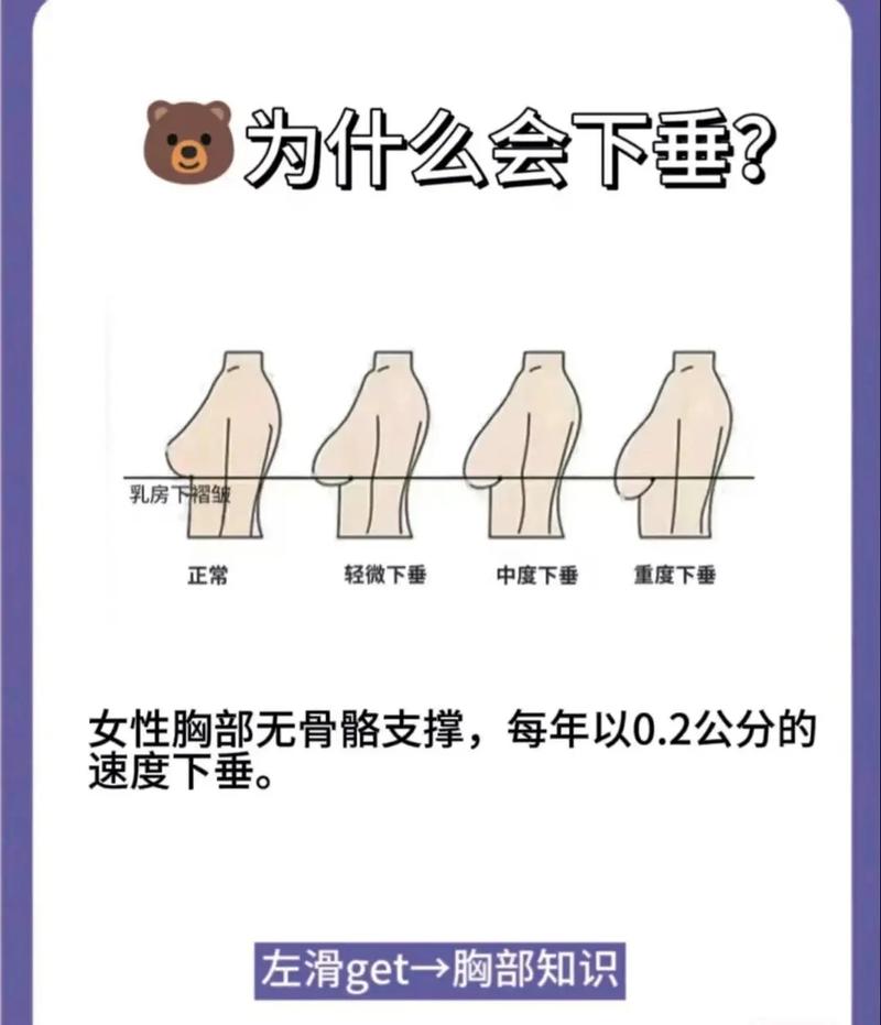 什么原因乳房下垂