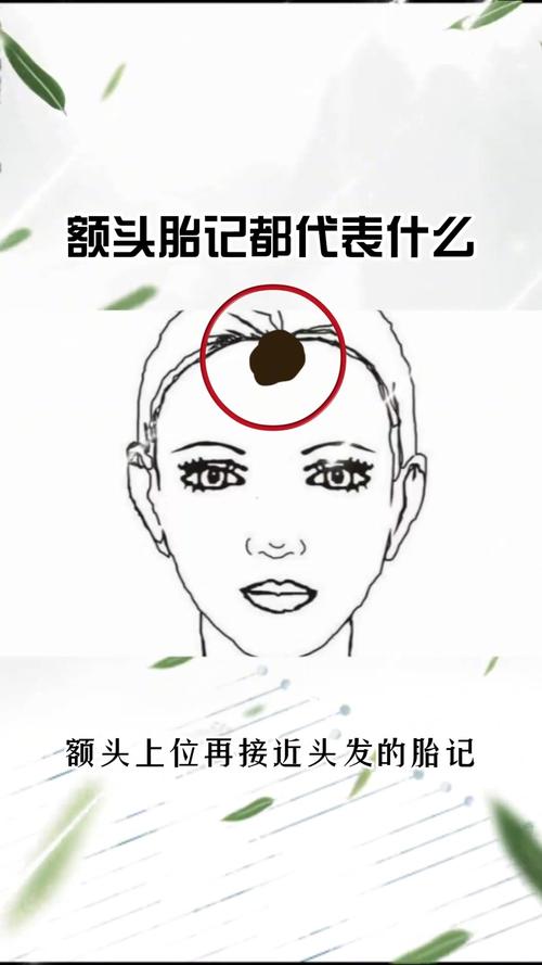 头上有胎记代表什么