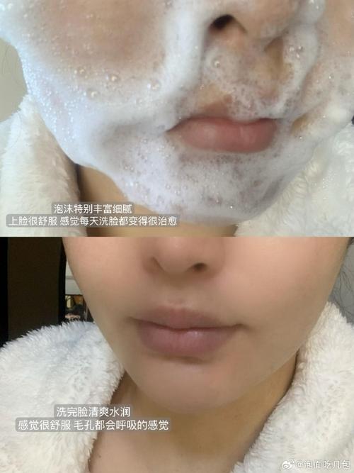 洗面奶用后过敏怎么办