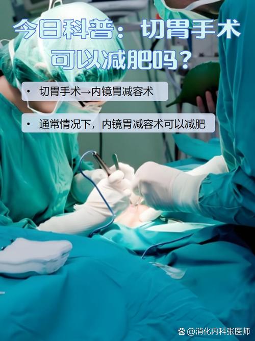 切胃为什么可以减肥