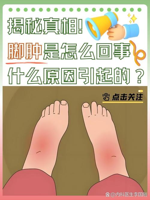 腿脚肿胀是什么原因