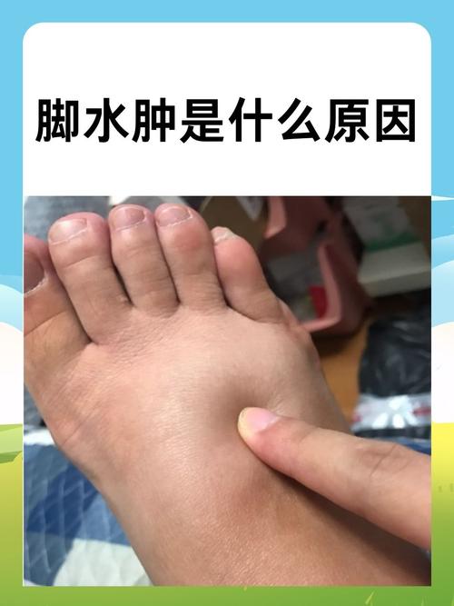 腿脚肿胀是什么原因