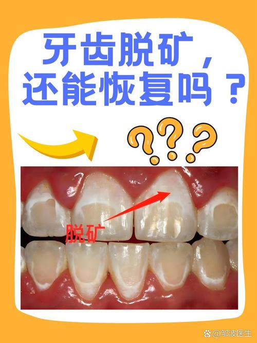 什么病会掉牙齿