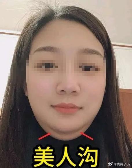 为什么会长双下巴
