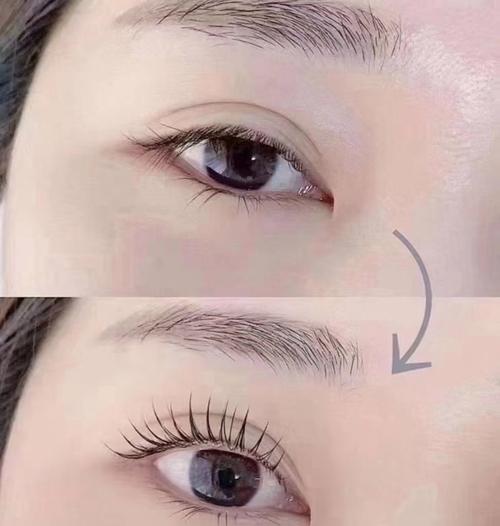 什么是翘睫