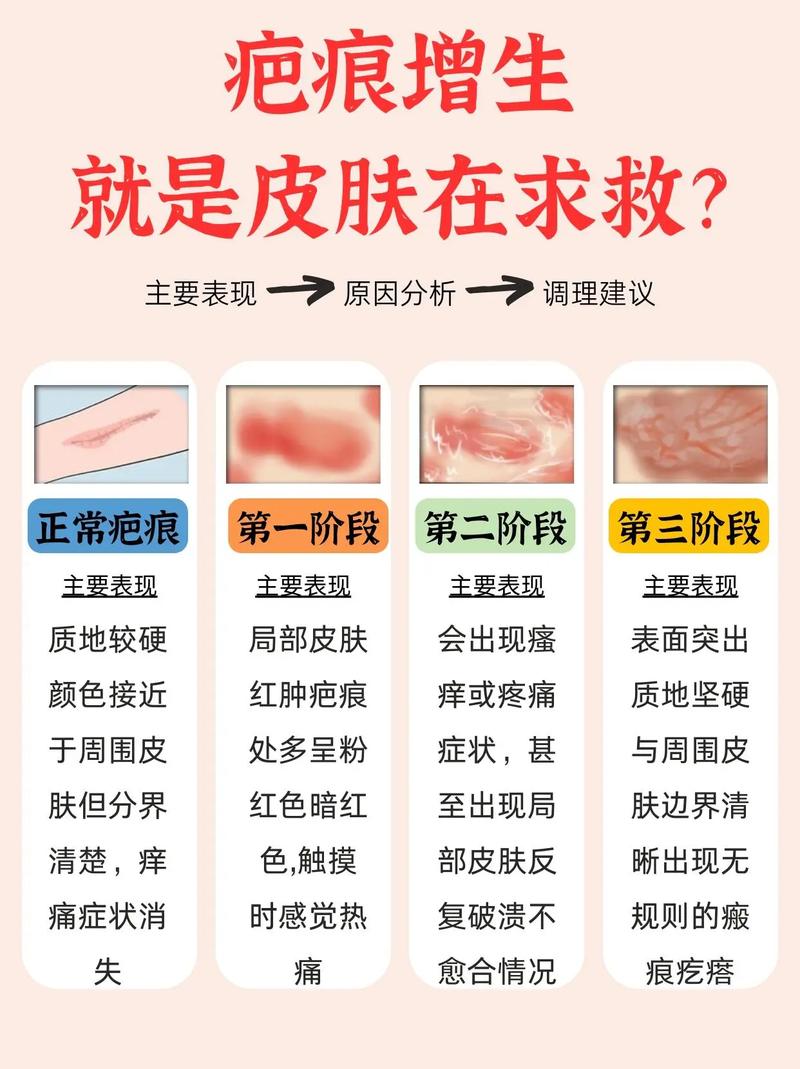 什么是瘢痕增生