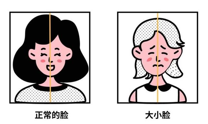 脸为什么一边大一边小