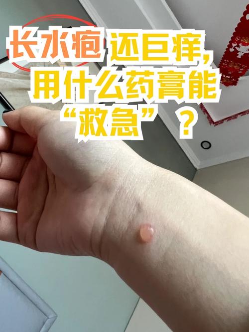 水痘是什么样的图片