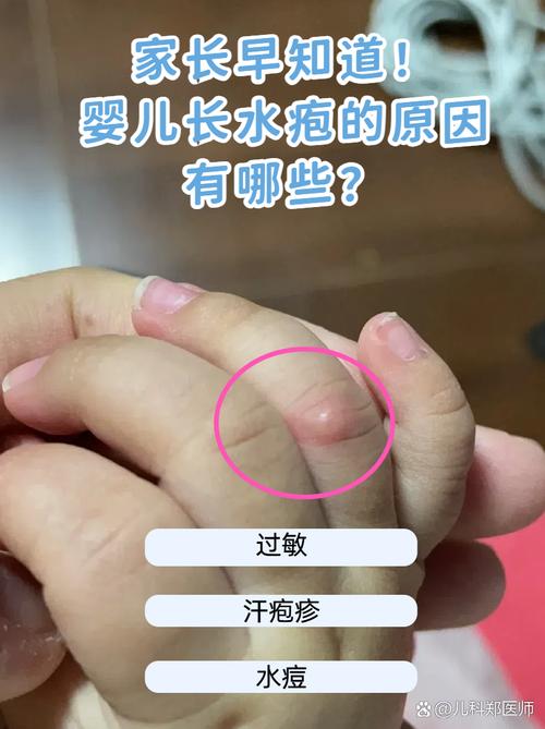 水痘是什么样的图片