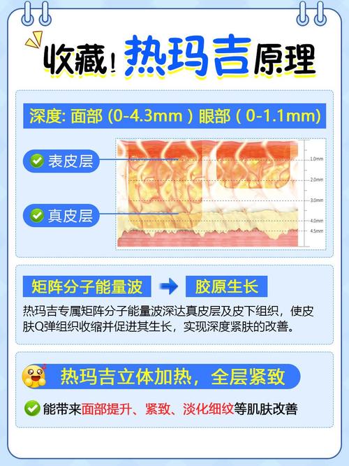 热玛吉是什么原理