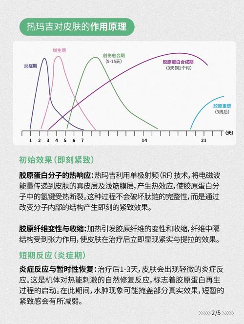 热玛吉是什么原理