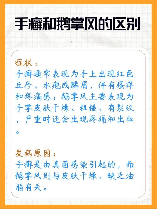 手癣是什么引起的