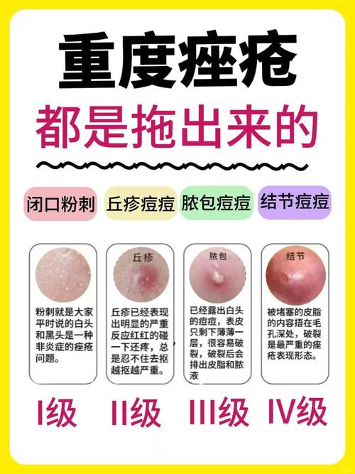 痤疮是什么样
