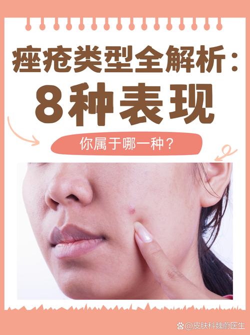 痤疮是什么样