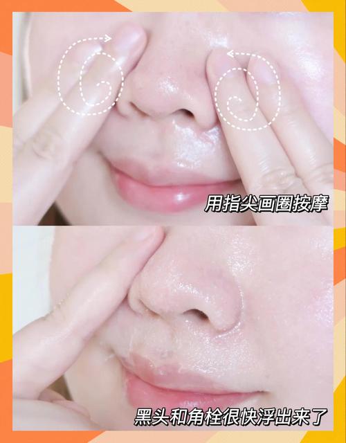 用洗面奶和卸妆水怎么清洁黑头