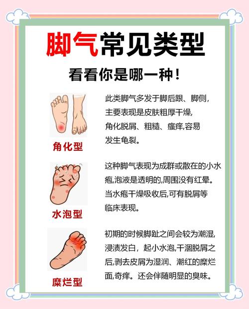 人脚为什么会臭