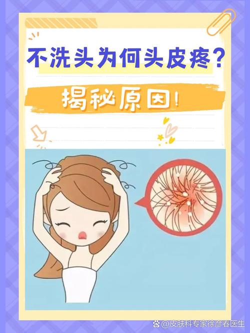 头皮刺痛是什么原因