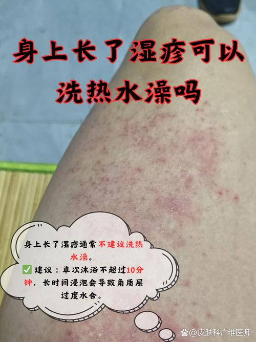 皮肤过敏用什么洗澡