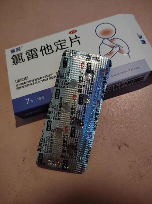 脸部过敏吃什么药好