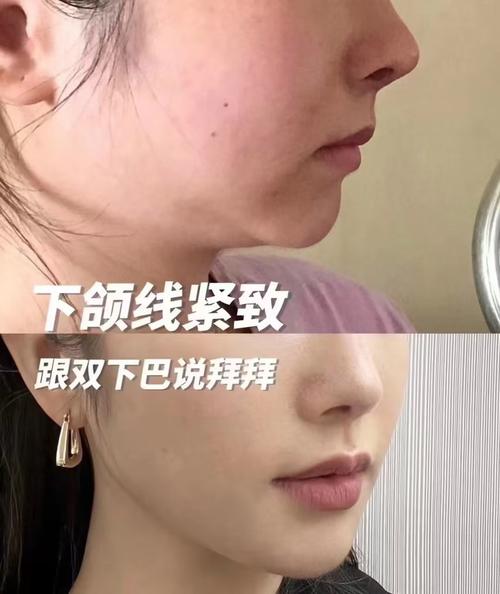 紧致是什么