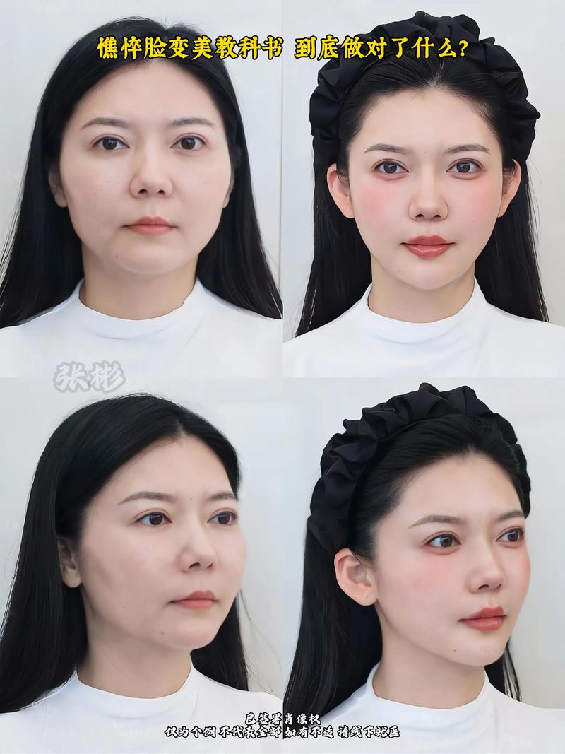 紧致是什么