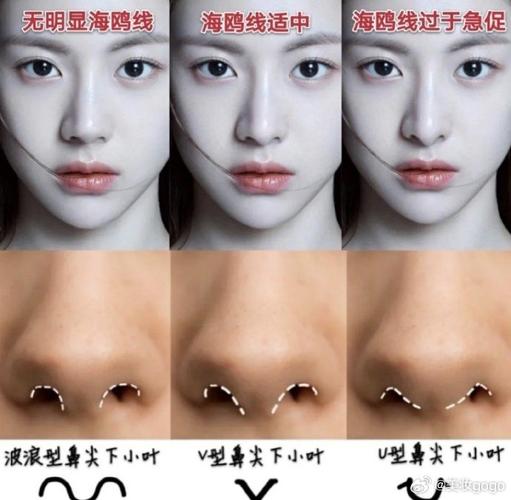 什么是鼻线